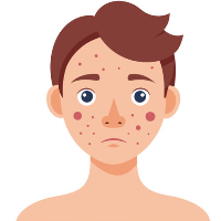 Skin & Hair Concern Spot & Blemish Treatment