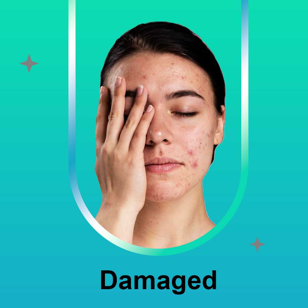 Skin Type Damaged